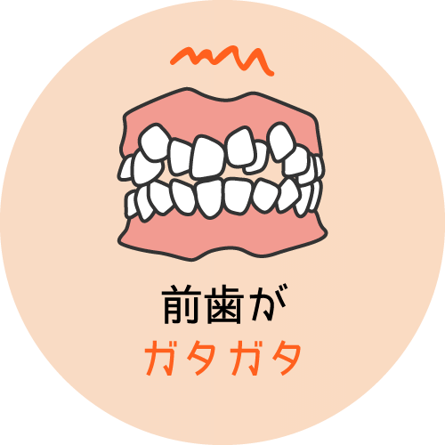 前歯がガタガタ