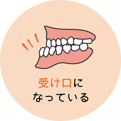 受け口になっている