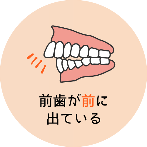 前歯が前に出ている