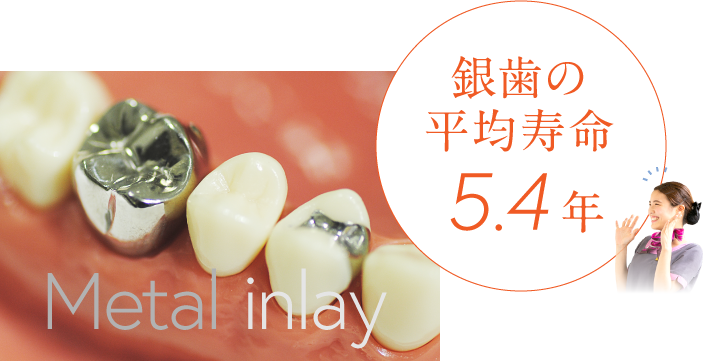 銀歯の平均寿命5.4年